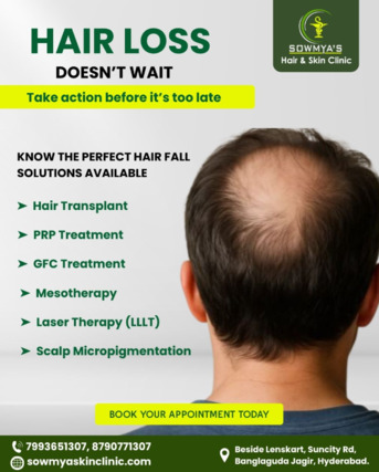 Hyderabad, Health, Restore Your Hair With Advanced Expert Care