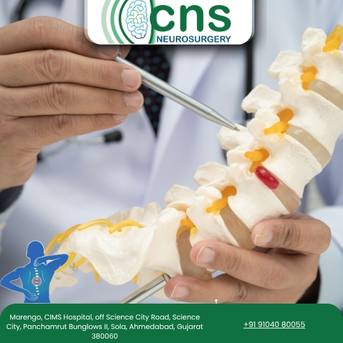 Ahmedabad, Health, Spine Tumor Surgery In Ahmedabad By Dr. Chirag Solanki