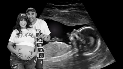 New York, Business, Which Place Offers Gentle And Caring Baby Ultrasounds?
