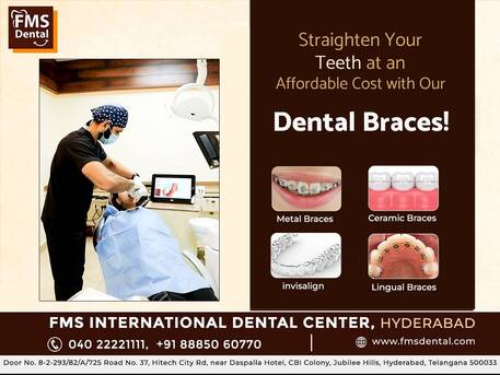 Hyderabad, Dental, Best Invisalign Near Me &ndash; Invisalign Providers In Hyderabad