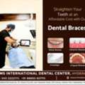 Best Invisalign Near Me &ndash; Invisalign Providers In Hyderabad