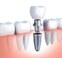 San Diego, Health, San Diego Teeth Whitening