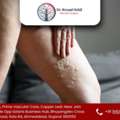 Improve Leg Health With Advanced Vein Care
