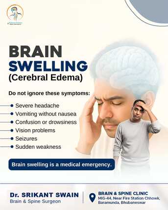 Bhubaneswar, Health, Brain Swelling (Cerebral Edema) | Brain & Spine Clinic Dr Srikant Swain, Bhubaneswar