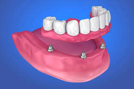 New Delhi, Dental, Denture In East Delhi