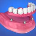 Denture In East Delhi