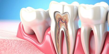 New Delhi, Dental, Best Root Canal Treatment In Delhi NCR
