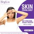 Best GFC Hair Treatment Near Nanakramguda | Reglow Skin Clinic