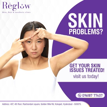 Hyderabad, Health, Lady Skin Specialist In Kokapet | Reglow Skin Clinic