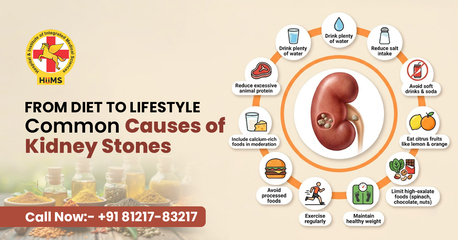 Chandigarh, Health, Natural Kidney Stone Care | Causes & Prevention Tips