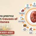 Natural Kidney Stone Care | Causes & Prevention Tips