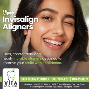 Hyderabad, Dental, Invisalign Aligners In Madinaguda