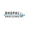 Trusted Clinic For The Best Hair Transplant In Bhopal