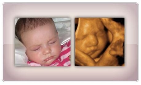 New York, Health, Accurate Early Gender DNA Test Services In Anaheim, California