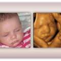 Accurate Early Gender DNA Test Services In Anaheim, California