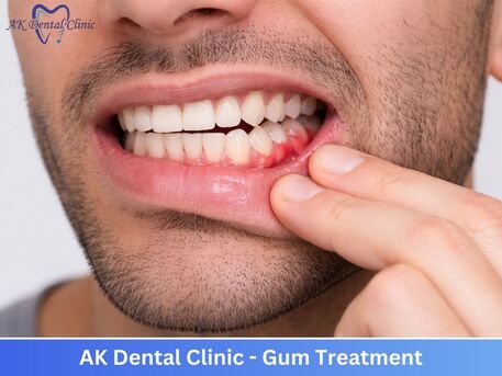 Mumbai, Dental, Professional Dentist In Vile Parle East | AK Dental Clinic