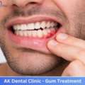 Professional Dentist In Vile Parle East | AK Dental Clinic