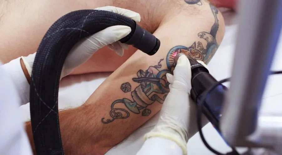 New York, Creative, Best Way To Remove Tattoo In Mckinney | Premier Tattoo