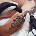 Best Way To Remove Tattoo In Mckinney | Premier Tattoo