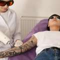 Eyebrow Tattoo Removal Near St Kilda | Safe & Professional Treatment