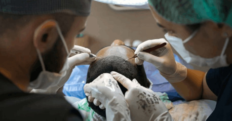 Gurgaon, Health, Advanced Hair Transplant Clinic In Gurgaon | SB Trichology
