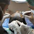 Advanced Hair Transplant Clinic In Gurgaon | SB Trichology