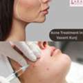 Effective Solutions For Acne Scars At Kara Skin Clinic In Vasant Kunj