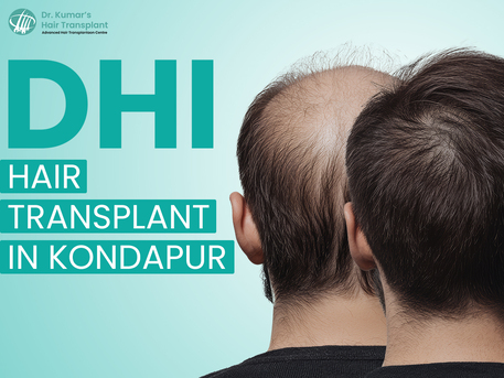 Hyderabad, Health, Natural-Looking Hair Restoration With DHI Technique In Kondapur