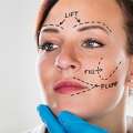 Facelift Surgery In Delhi - Dr Rajat Gupta
