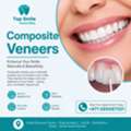 Get A Beautiful Smile With Composite Veneers At Top Smile Dental Clinic