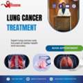 Best Lung Cancer Treatment In Ahmedabad With Advanced Medical Care
