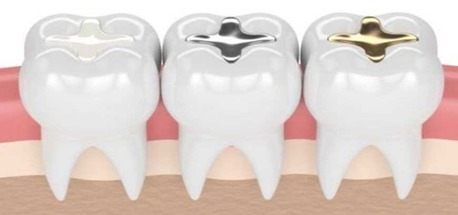 Kabul, Dental, Best Dental Clinic In Coimbatore With Top Dental Treatments