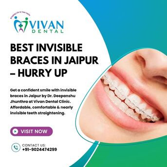 Jaipur, Dental, Best Invisible Braces In Jaipur &ndash; Hurry Up