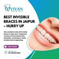 Best Invisible Braces In Jaipur &ndash; Hurry Up