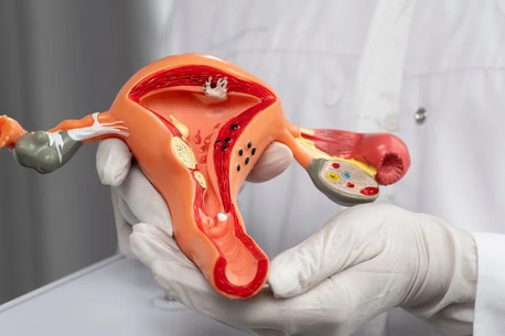 New Delhi, Health, Dr. Manish Singhal Best Cervical Cancer Doctor Delhi