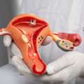 Dr. Manish Singhal Best Cervical Cancer Doctor Delhi