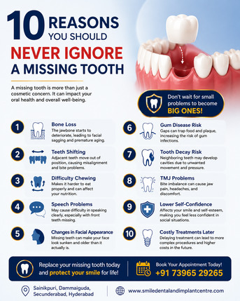 Hyderabad, Dental, 10 Reasons You Should Never Ignore A Missing Tooth