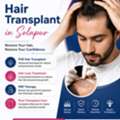 Hair Transplant In Solapur | Get Fuller & Natural-Looking Hair