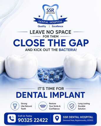 Kurnool, Dental, Dental Implant Specialists | SSR Dental Hospital In Rajahmundry