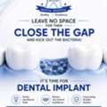 Dental Implant Specialists | SSR Dental Hospital In Rajahmundry
