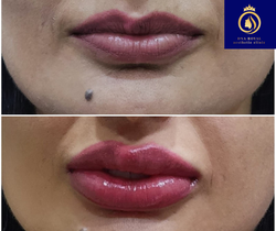 Thane, Fashion & Design, Enhance Your Beauty With DNA Royal Lip Blushing In Thane.