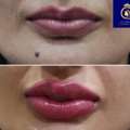 Enhance Your Beauty With DNA Royal Lip Blushing In Thane.