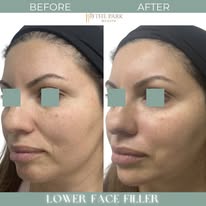 New York, Health & Beauty Items, Professional Facial Treatment For Youthful Skin Glow