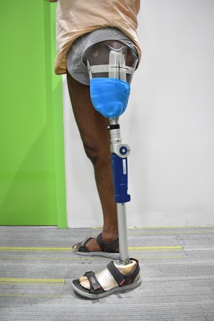 Kurnool, Health, Best Artificial Limb Fitting Center In Hyderabad