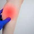 Calf Strain Physiotherapy In Gurgaon &ndash; Effective Pain Relief & Fast Recovery