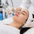 Struggling With Acne Scars? Discover Advanced Removal Treatments In Dubai