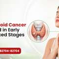 Thyroid Cancer Treatment & Care Support In India