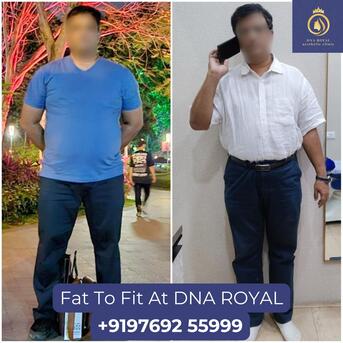 Thane, Fashion & Design, Transform Your Body With Fat Reduction In Thane | DNA Royal.
