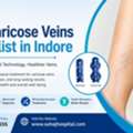 Best Varicose Veins Specialist In Indore