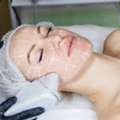 Carbon Laser Peel Treatment: Brighter Skin